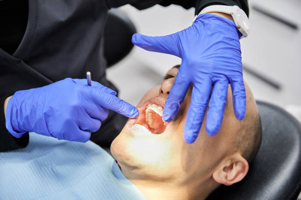 Best Root Canal Emergency Dentist  in Healdsburg, CA